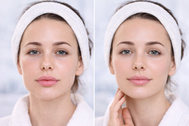 do.pislya.korektsiya.medestet.vin