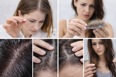 problem.hair.medestet.vin