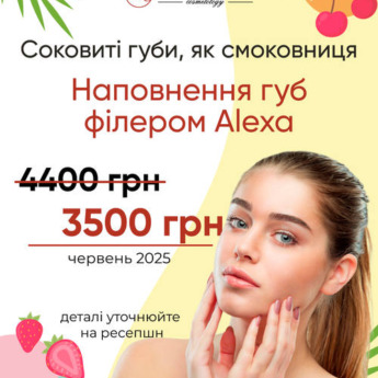 Наповнення губ філером Alexa