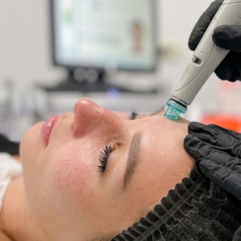hydrofacial.medestet.vinnytsia
