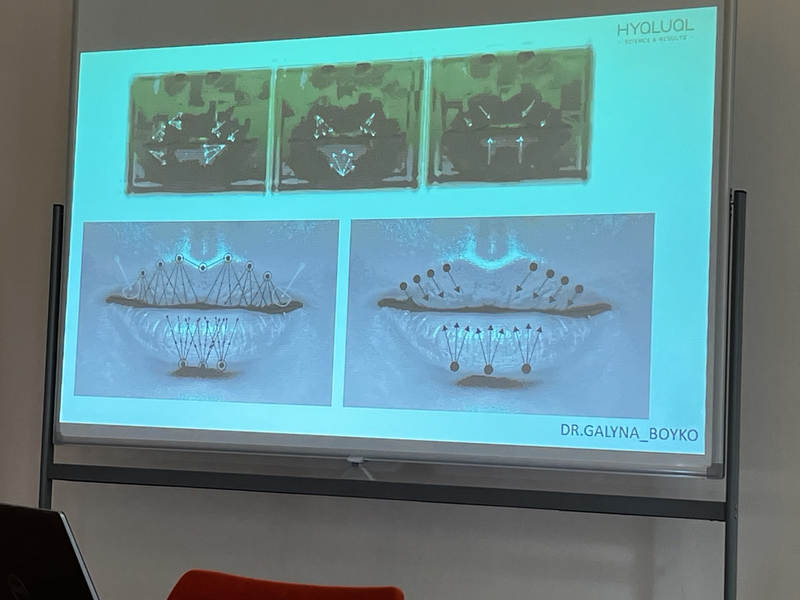 Слайд презентації доповідача про корекцію губ