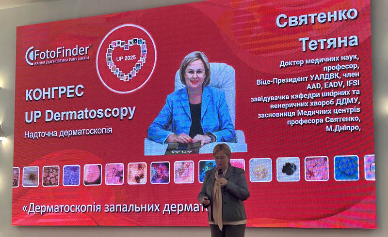 Слайд з конгресу UP Dermatoscopy 2025