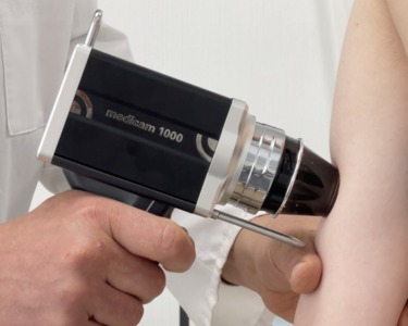 FotoFinder Medicam 1000s IMG_2330