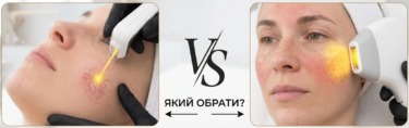 yellowlaservsipl